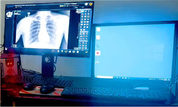 Tsigereda X-ray machine